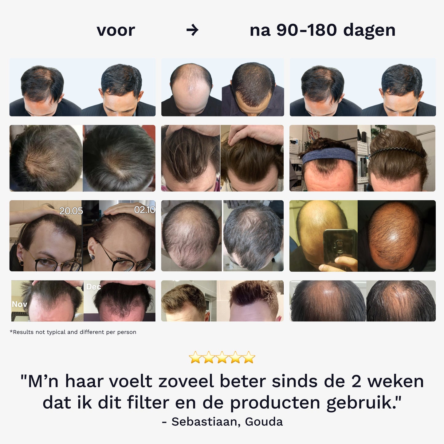 Lisotte Haaruitval Preventie Kit